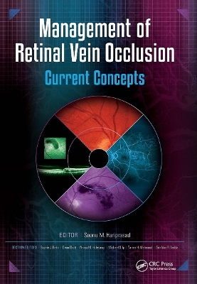 Management of Retinal Vein Occlusion - Seenu Hariprasad