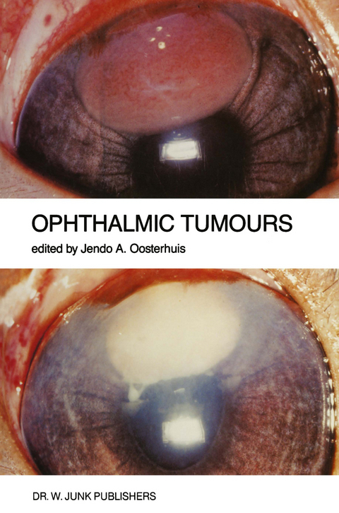 Ophthalmic Tumours - 