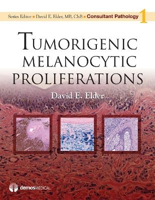 Tumorigenic Melanocytic Proliferations - David E. Elder