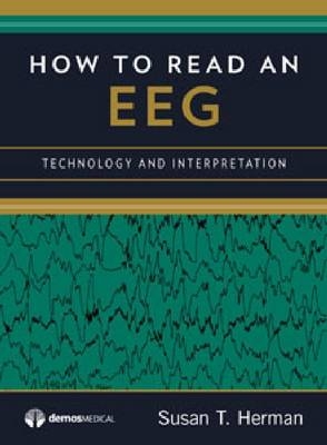 How to Read an EEG - Susan T. Herman