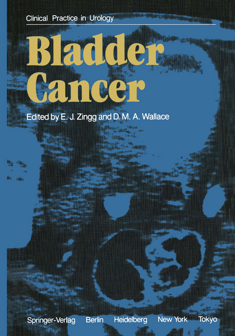 Bladder Cancer - 