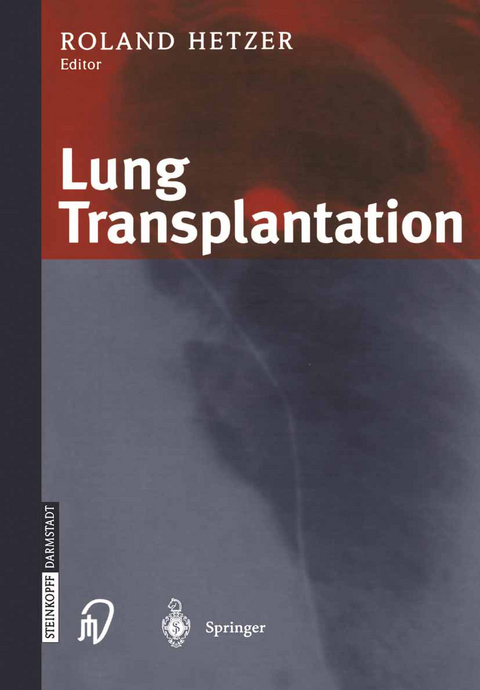 Lung Transplantation - 