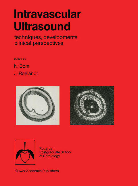 Intravascular ultrasound - 