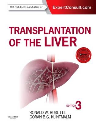 Transplantation of the Liver - Ronald W. Busuttil, Goran B. Klintmalm