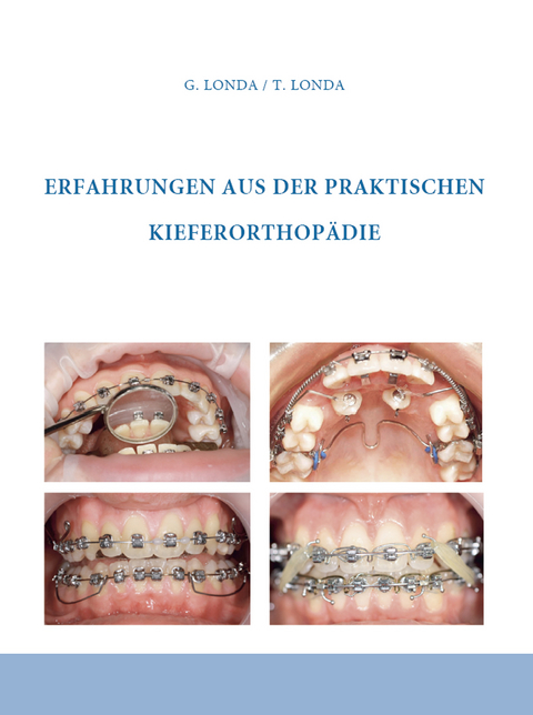 Erfahrungen aus der praktischen Kieferorthopädie - Gennadij Londa, Theresia Londa