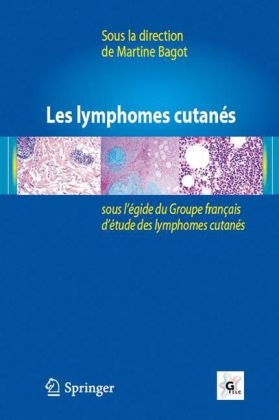 Les Lymphomes Cutanés - 