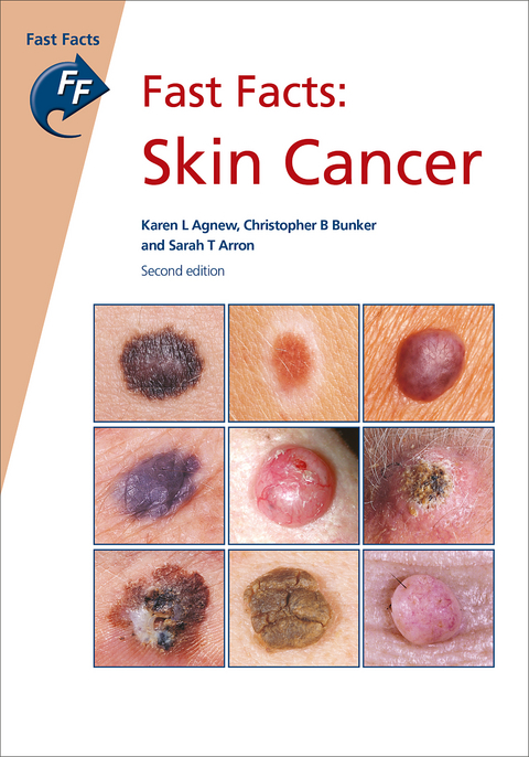 Fast Facts: Skin Cancer - Karen L Agnew, Christopher B Bunker, Sarah T Arron