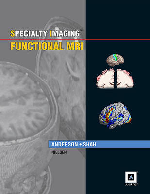 Specialty Imaging: Functional MRI - Dr. Jeffrey Anderson