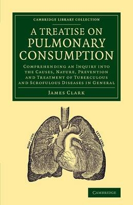 A Treatise on Pulmonary Consumption - James Clark