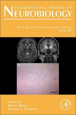 Metal Related Neurodegenerative Disease - 