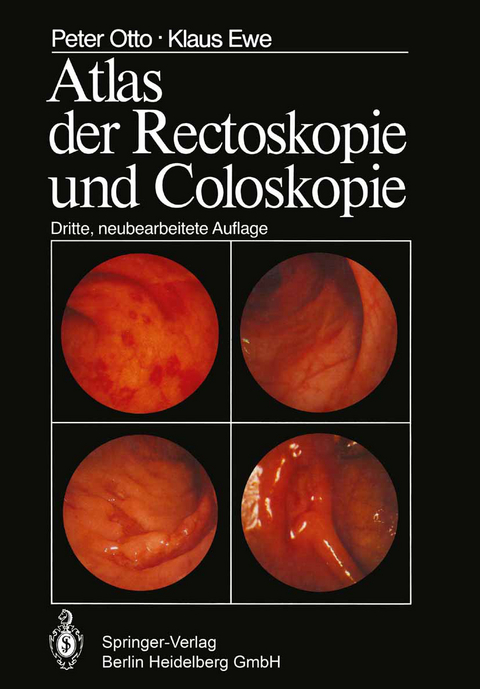 Atlas der Rectoskopie und Coloskopie - P. Otto, K. Ewe