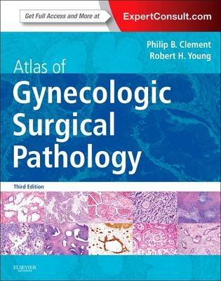 Atlas of Gynecologic Surgical Pathology - Philip B. Clement, Robert H. Young