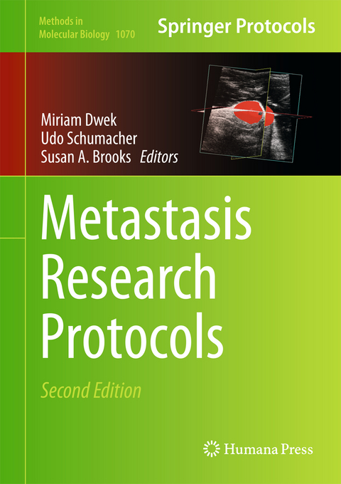 Metastasis Research Protocols - 