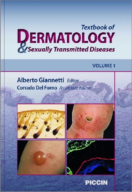 Textbook of Dermatology & Sexually Transmitted Diseases - 