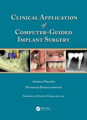 Clinical Application of Computer-Guided Implant Surgery - Andreas Parashis, Panagiotis Diamantopoulos