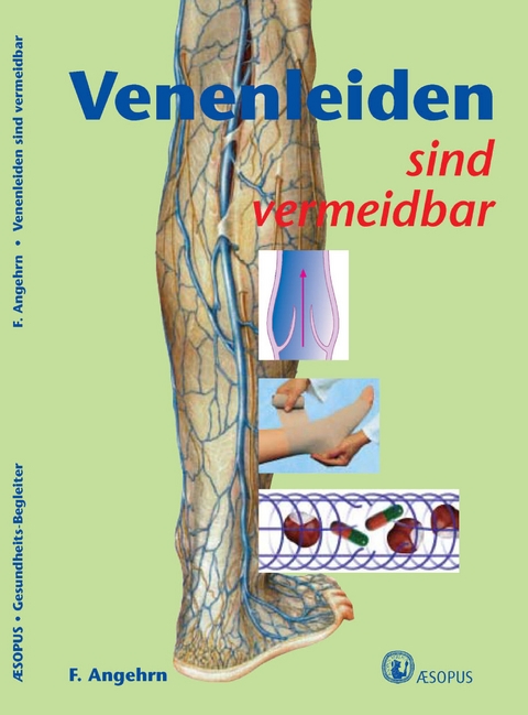 Venenleiden sind vermeidbar - Fiorenzo Angehrn