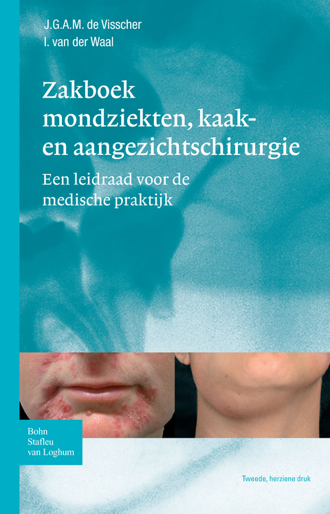 Zakboek mondziekten, kaak- en aangezichtschirurgie - J.G.A.M. de Visscher, I. van der Waal