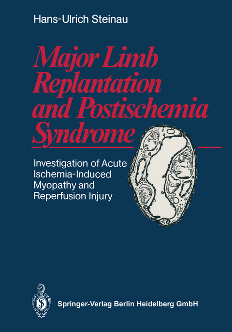 Major Limb Replantation and Postischemia Syndrome - Hans-Ulrich Steinau