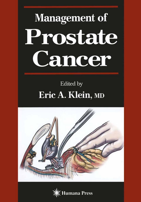 Management of Prostate Cancer - 