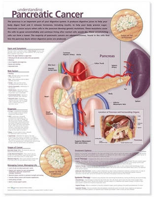 Understanding Pancreatic Cancer Anatomical Chart