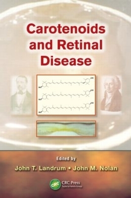 Carotenoids and Retinal Disease - 