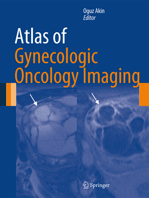 Atlas of Gynecologic Oncology Imaging - 