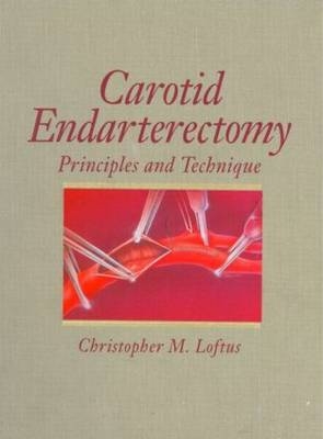 Carotid Endarterectomy - Christopher M. Loftus