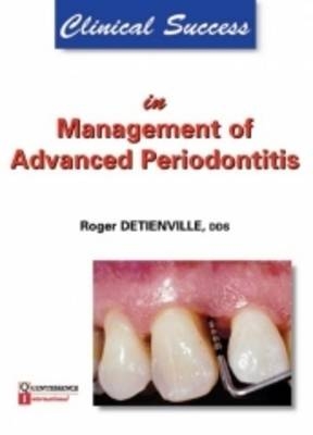 Clinical Success in Management of Advanced Periodontitis - Roger Detienville