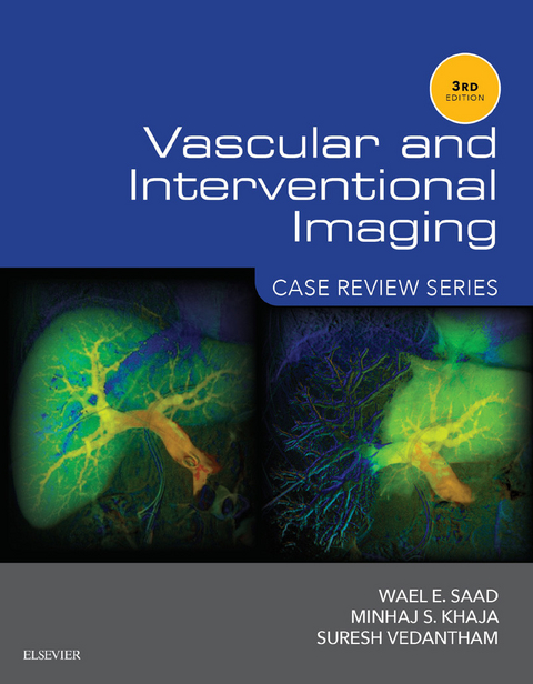 Vascular and Interventional Imaging: Case Review Series -  Wael E. Saad,  Minhaj Khaja,  Suresh Vedantham