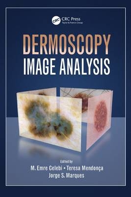 Dermoscopy Image Analysis - 