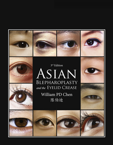 Asian Blepharoplasty and the Eyelid Crease E-Book -  William P. Chen