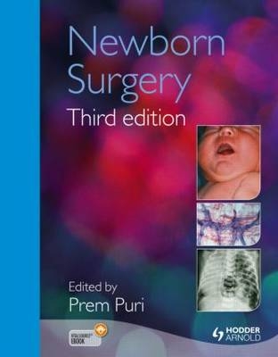 Newborn Surgery 3E -  Prem Puri