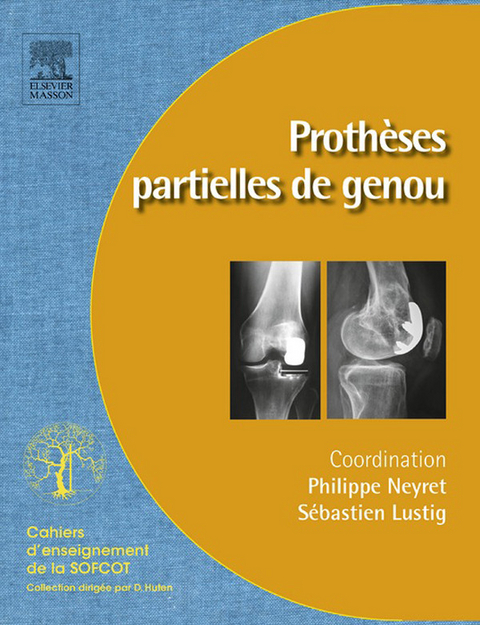 Prothèses partielles du genou -  Apcort,  Sebastien Lustig,  Philippe Neyret