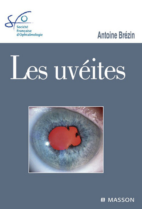 Les uvéites -  Antoine Brezin,  Societe Francaise (SFO) d'Ophtalmologie