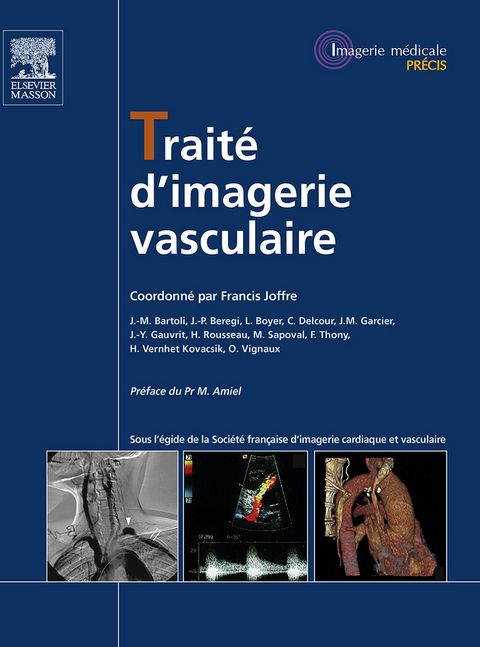 Traité d''imagerie vasculaire -  Francis Joffre