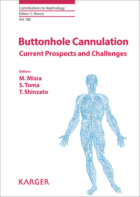 Buttonhole Cannulation - 