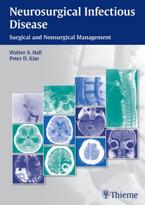 Neurosurgical Infectious Disease - 