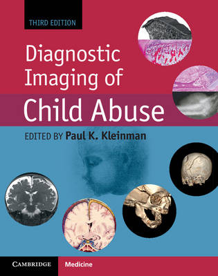 Diagnostic Imaging of Child Abuse - 