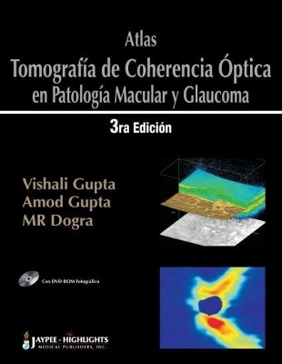 Atlas – Tomografía de Coherencia Óptica en Patología Macular y Glaucoma - Vishali Gupta, Amod Gupta, Mangat Ram Dogra