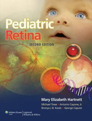 Pediatric Retina - Mary Elizabeth Hartnett