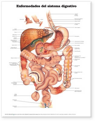 Diseases of the Digestive System Anatomical Chart in Spanish (Enfermedades del Sistema Digestivo)