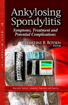 Ankylosing Spondylitis - 