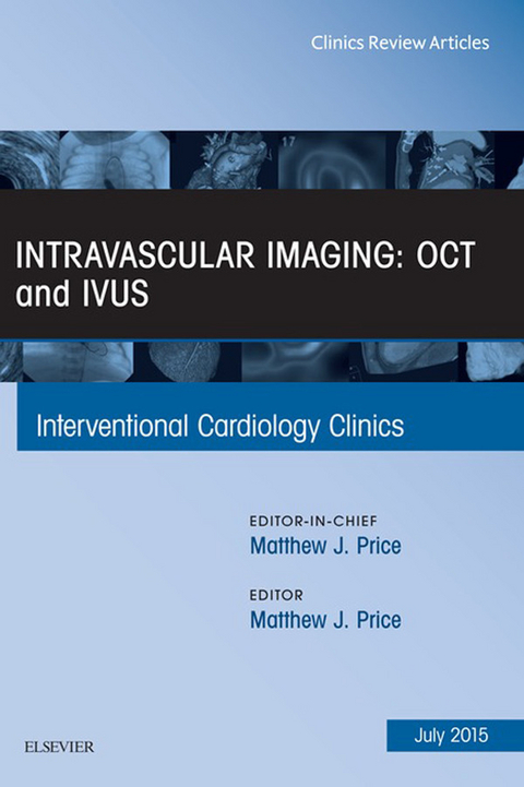 Intravascular Imaging: OCT and IVUS, An Issue of Interventional Cardiology Clinics -  Matthew J. Price