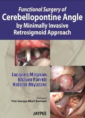 Functional Surgery of Cerebellopontine Angle by Minimally Invasive Retrosigmoid Approach - Jacques Magnan, Bhavin Parikh, Hidemi Miyazaki