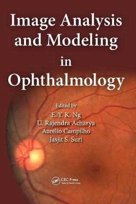 Image Analysis and Modeling in Ophthalmology - 