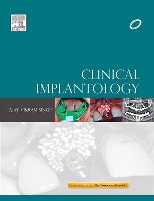 Clinical Implantology -  Ajay Vikram Singh