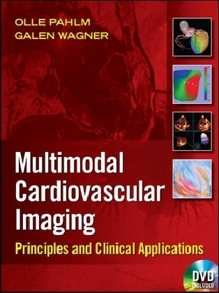 Multimodal Cardiovascular Imaging: Principles and Clinical Applications - Olle Pahlm, Galen Wagner