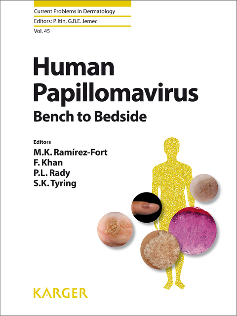 Human Papillomavirus - 