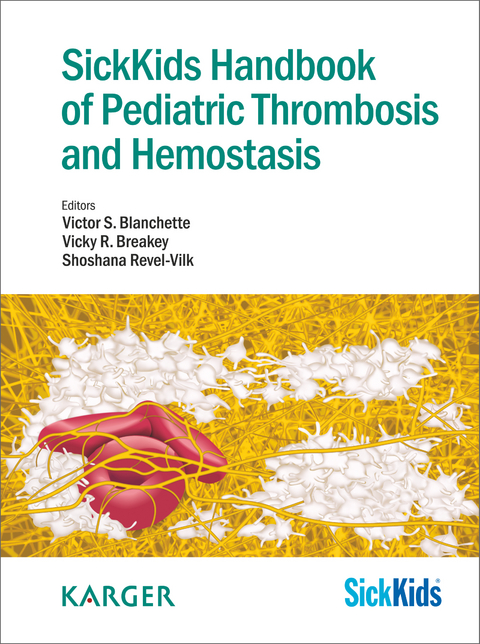 SickKids Handbook of Pediatric Thrombosis and Hemostasis - 