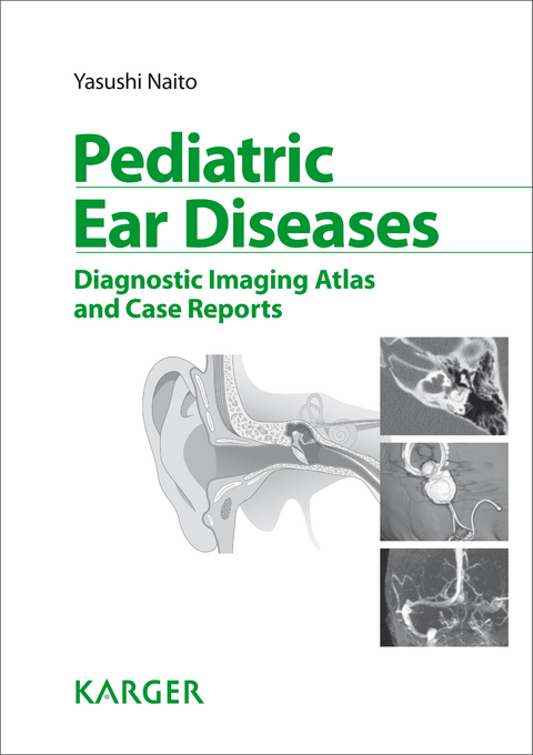 Pediatric Ear Diseases - Y. Naito